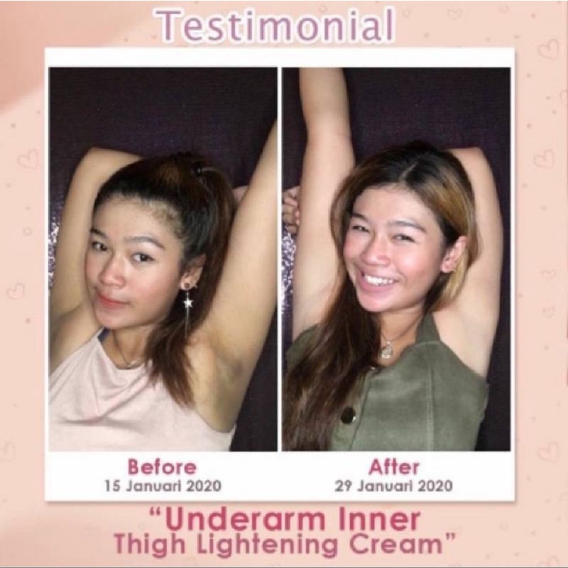 MS GLOW UNDERARM/pemutih ketiak