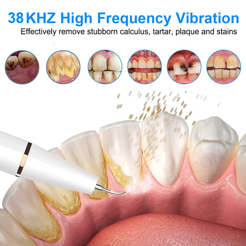 Alat Pembersih Karang Gigi Dental Scaling Sonic Elektrik 38KHZ 1 Set 3 Modes Perontok Dan Pembersih Karang Gigi Alat Scaling Karang Gigi Dental Remover With Light Penghilang Pemecah Karang Gigi GS5