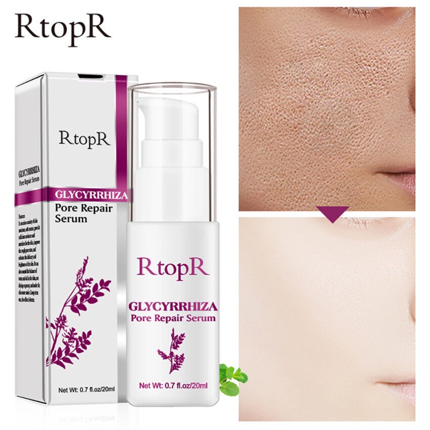 RtopR GLYCYRRHIZA Pore Repair Serum  Perbaikan Pori-pori Wajah Pengontrol Minyak Hidrasi Efektif Mengecilkan Pori-pori