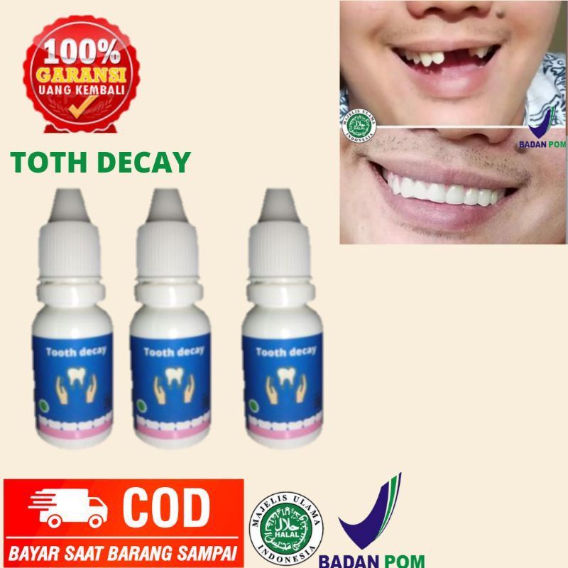 TOOTH DECAY ( Penumbuh gigi Ompong & Gigi berlubang ) Bisa Cod