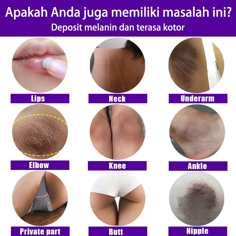 Cream Krim pemutih selangkangan Cream Krim pemutih ketiak Cream pemutih leher Cream pemutih badan Krim pemutih dan tangan kaki Cream pemutih kulit Pencerah selangkangan Ketiak Hitam Pencerah Bibir Nipple Private Vagina Pemutih Essence