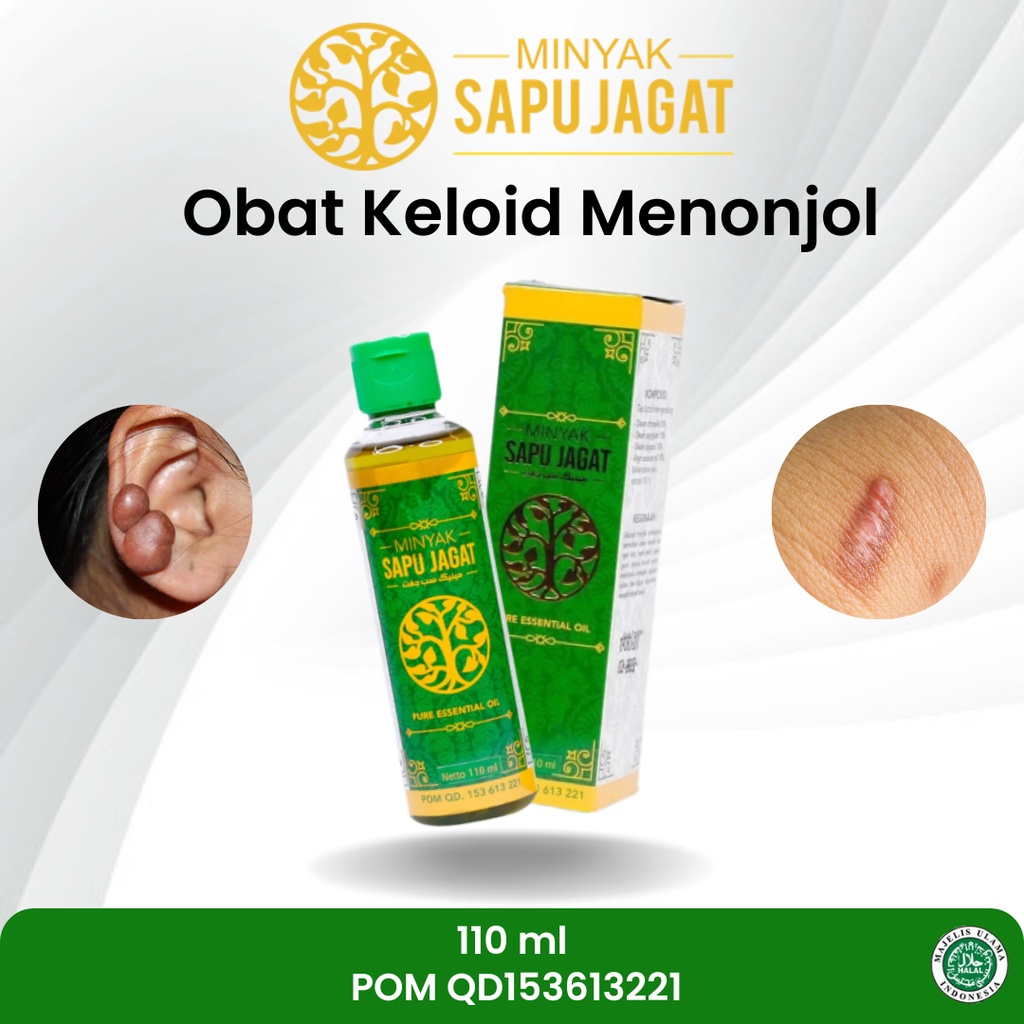 Jual Sapnu Herbal Obat Keloid, Keloid Menonjol, Penghilang Bekas Luka