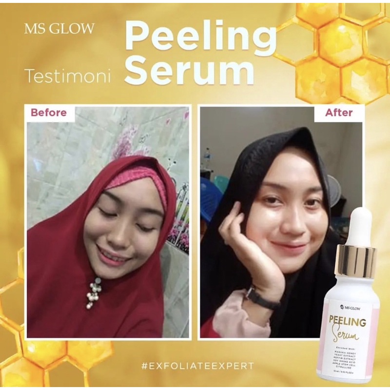 SALE SERUM PEELING MSGLOW