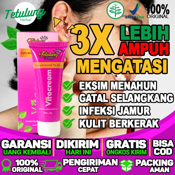 obat gatal eksim tradisional obat gatal eksim di selangkangan obat gatal karena eksim