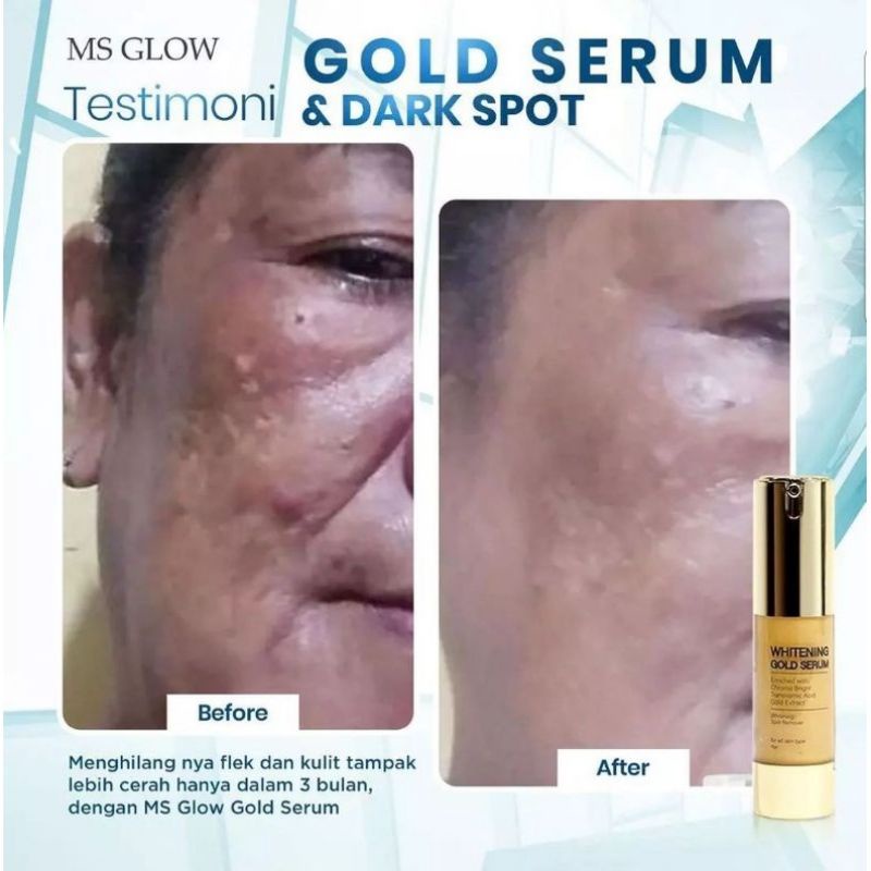 PAKET WAJAH ULTIMATE FREE DARK SPOT + SERUM GOLD MS GLOW ORIGINAL (SUDAH BER BARCODE)