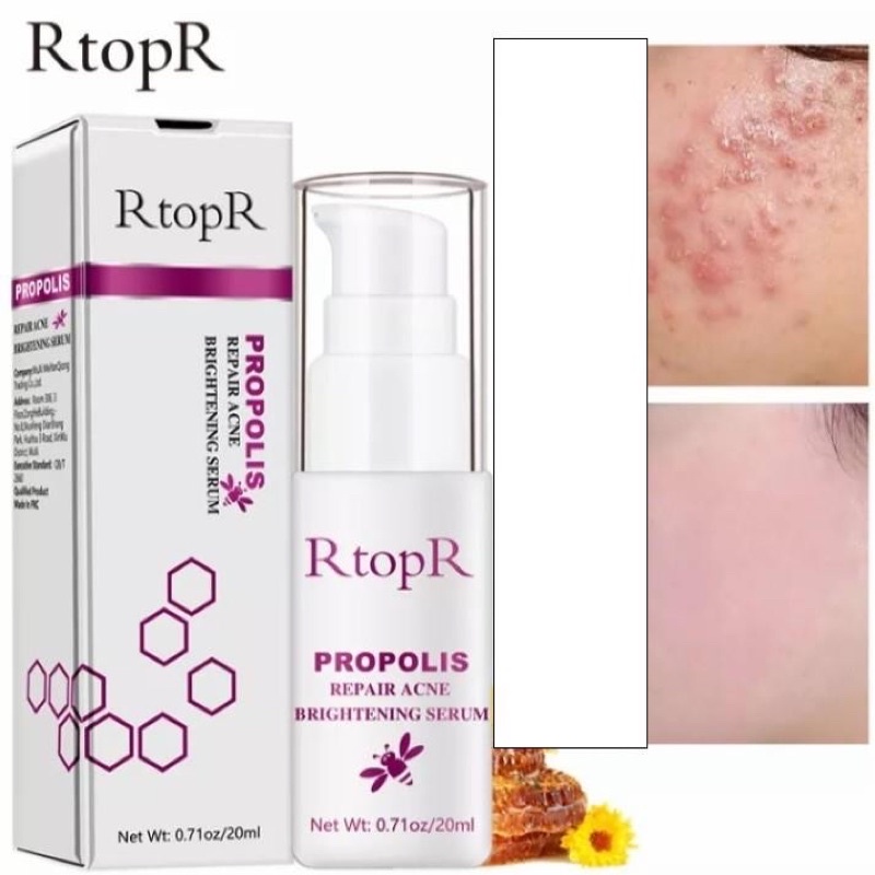 【BPOM】 RtopR PROPOLIS Repair Acne Brightening Serum BRIGHTENING SERUM / JERAWAT / MENCERAHKAN