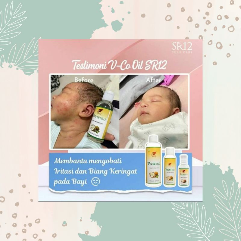 Vco Oil SR12 Vco Minyak Kelapa untuk Bayi atasi Ruam Popok / Kerak Kepala / Gatal Alergi