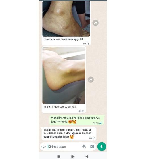 Elegant--Aish C Bright Underarm Cream | Aish Serum | Aish Neck Brightening | C-Bright Serum dan Crea