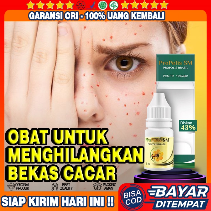 Obat Bekas Cacar Air, Penghilang Milia,  Penghilang Bekas Cacar Di Wajah Penghilang Bopeng