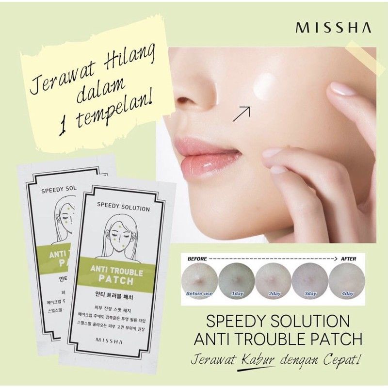 [BPOM]ACNE PATCH By Missha Speedy Solution Anti Trouble Patch