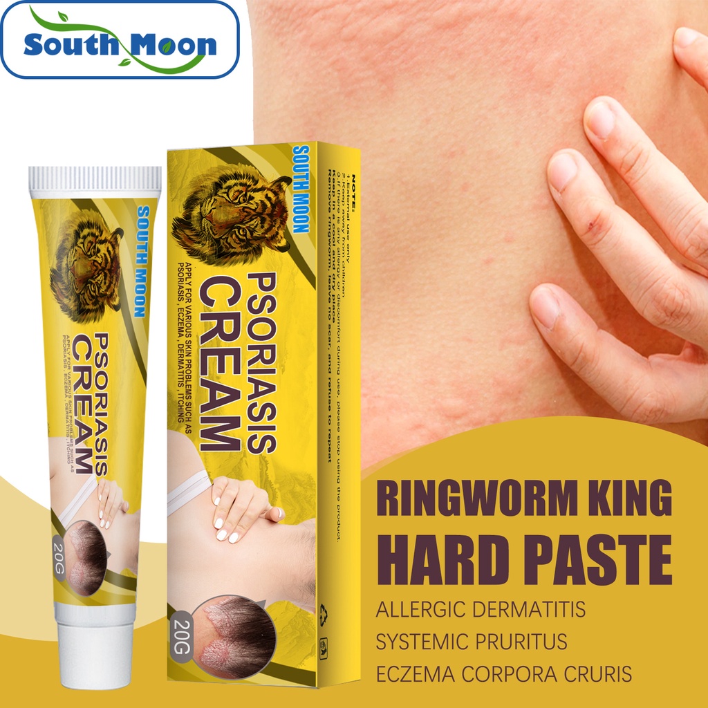 Itching Cream Kurap Bau Kaki Dermatitis Antijamur Antipruritic-Psoriasis Cream 20gr Perawatan Kulit 