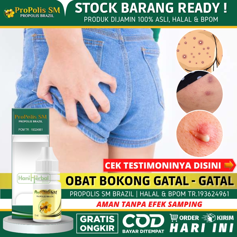 Obat Herbal Untuk Jerawat di Bokong, Salep Jerawat di Pantat, Penghilang Jerawat di Pantat, Pantat B