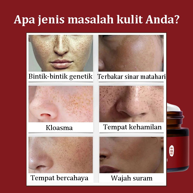 Krim pemutih Bintik Krim Pemutih Krim Pemutih wajah Krim Penghilang Melasma 30G