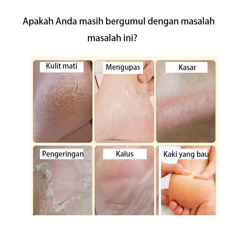 obat kaki pecah dan kering krim kaki pecah dan kering Foot mask Foot Cream Obat Kaki Pecah Dan Kering Masker kaki pengelupas kulit mati Enghalus tumit kasar 100ML Bahan susu alami / Bergizi dan melembabkan / Menghilangkan kulit mati dari kaki