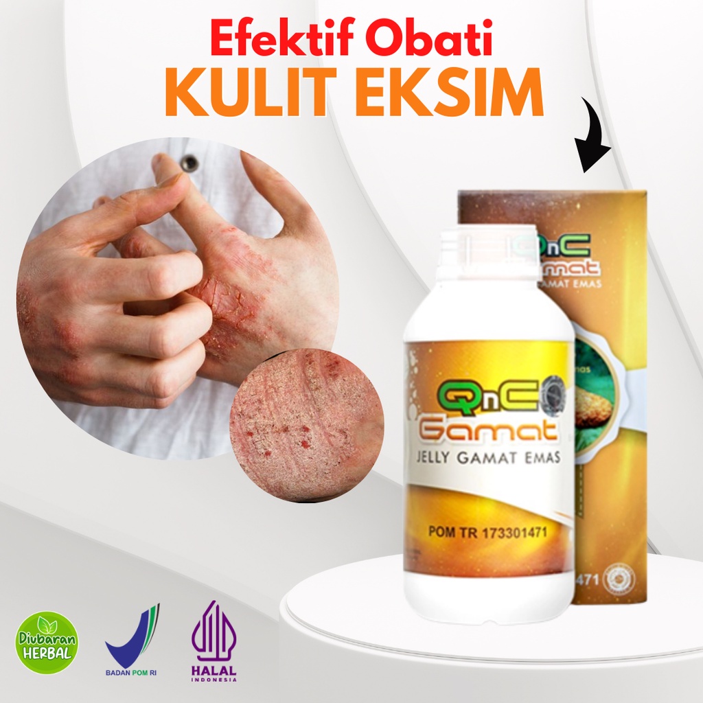 Jual Obat Eksim Kering Dan Basah Menahun Gatal Lecet Dan Berkerak Qnc