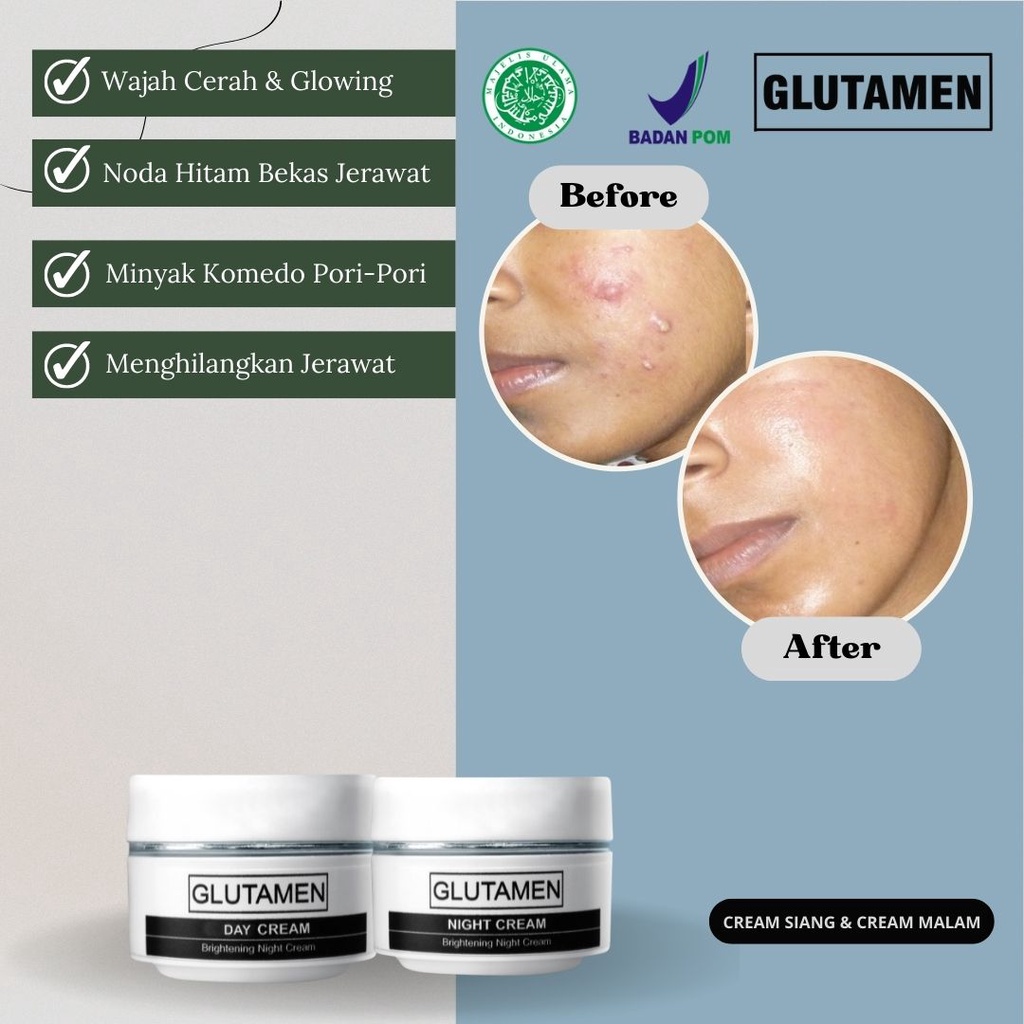 Glutamen Skincare BPOM Cream Siang Krim Malam Pemutih Wajah Penghilang Jerawat Pria
