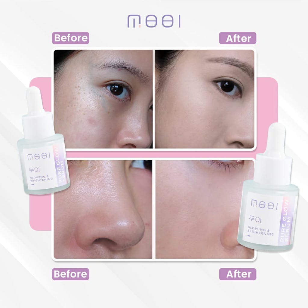 [ORIGINAL BONUS POUCH] MOOI Pure Glow Serum SERUM WAJAH GLOWING KOREA