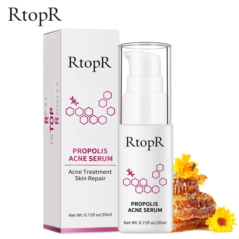 [BPOM]RtopR Propolis Perbaikan Jerawat Anti Jerawat Serum Pencerah Jerawat Bekas Jerawat Serum Pembersih Bintik-Bintik Bekas Jerawat Mengecilkan Pori-Pori Menghilangkan Jerawat Perawatan Minyak kontrol Jerawat 20ml