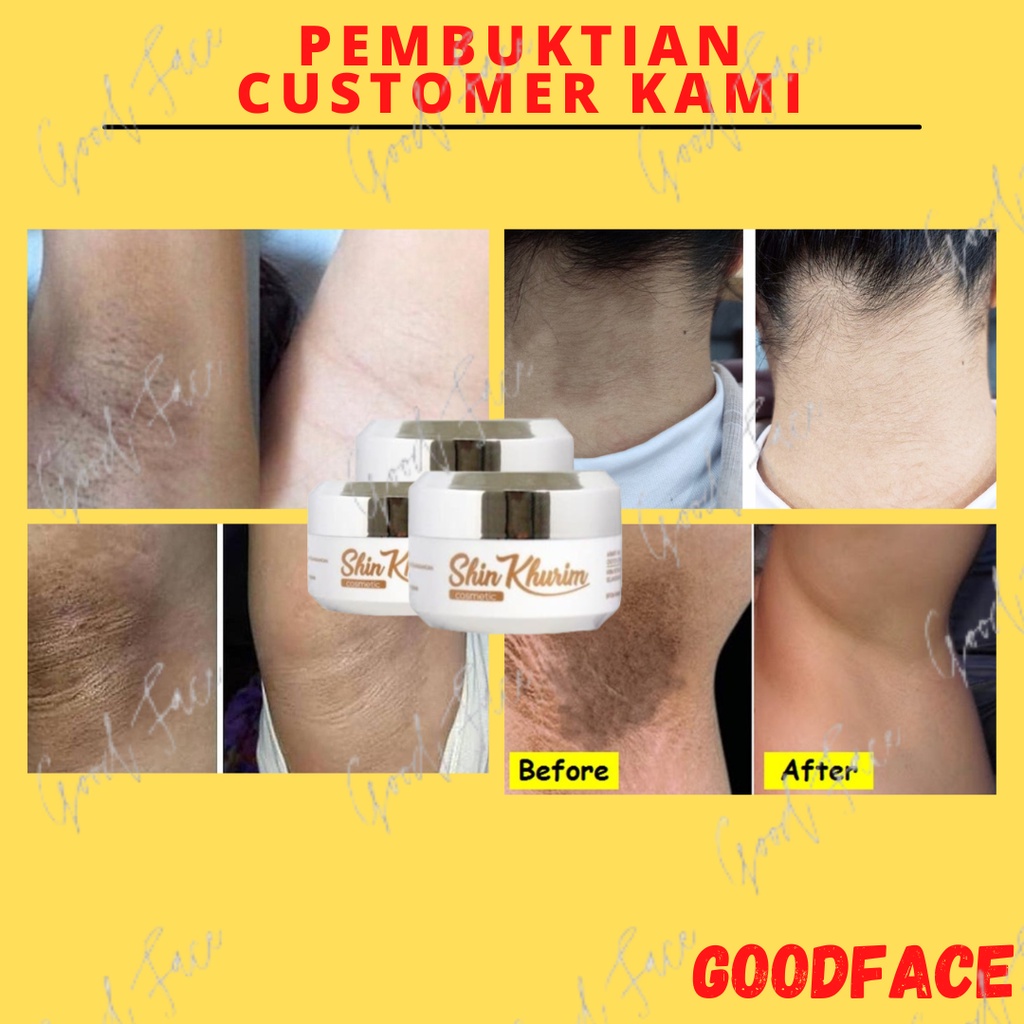 PENCERAH KETIAK - SHINKURIM CREAM PEMUTIH KETIAK - PEMUTIH SELANGKANGAN - PEMUTIH BADAN PERMANEN