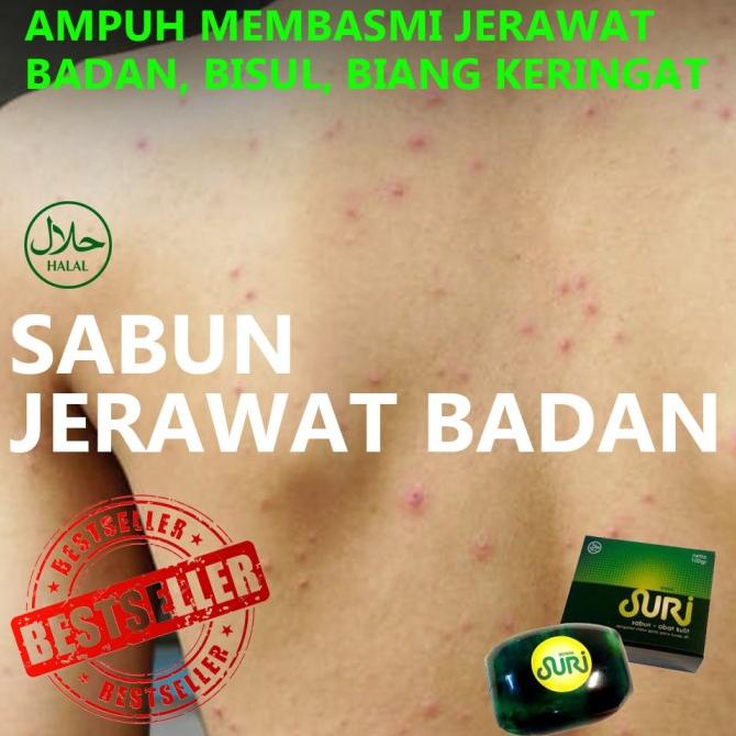 Penghilang Jerawat Biang Keringat Punggung - Sabun Suri