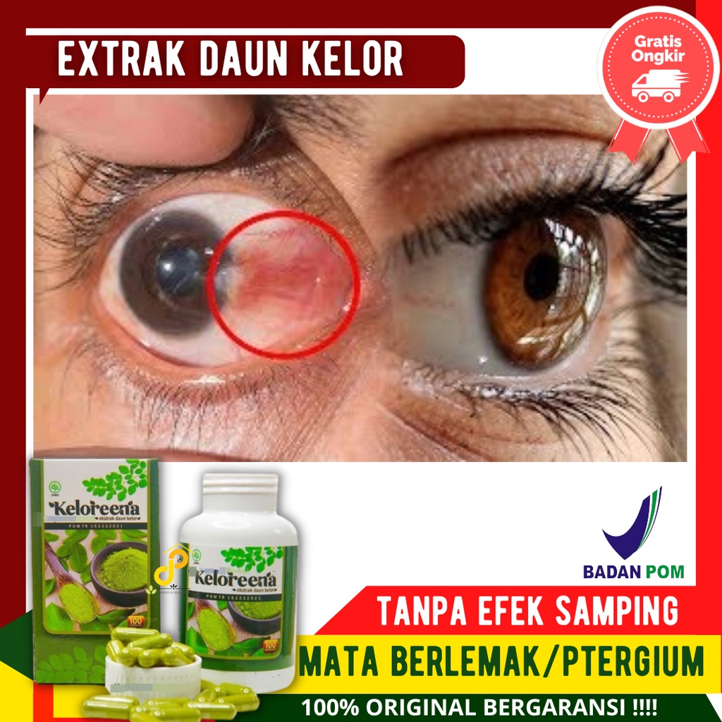 Obat Gumpalan Lemak Di Kelopak Mata, Obat Penghilang Mata Berlemak, Saraf Mata Rusak, Pemutih Mata K