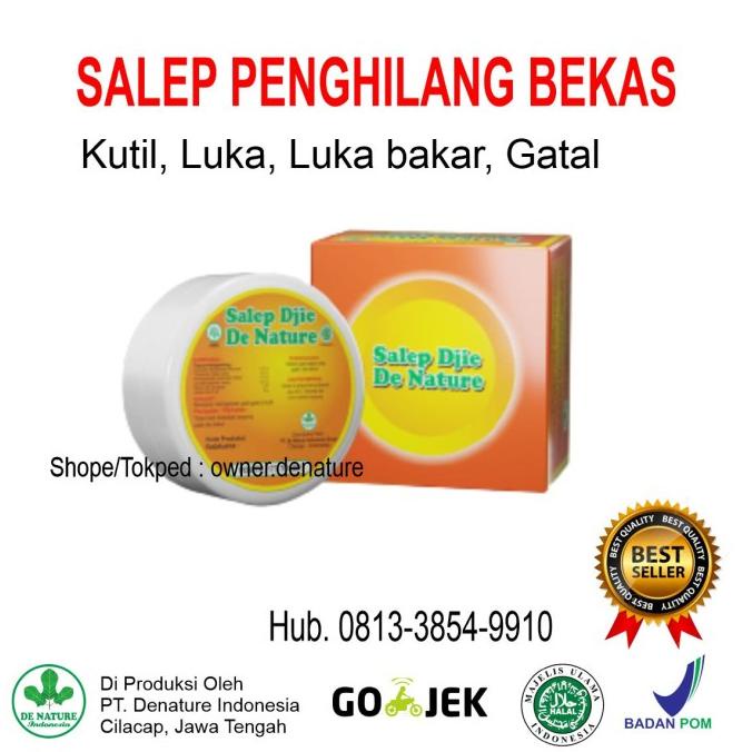 OBAT SALEP PENGHILANG BEKAS LUKA KUTIL GATAL GATAL CACAR LUKA BAKAR