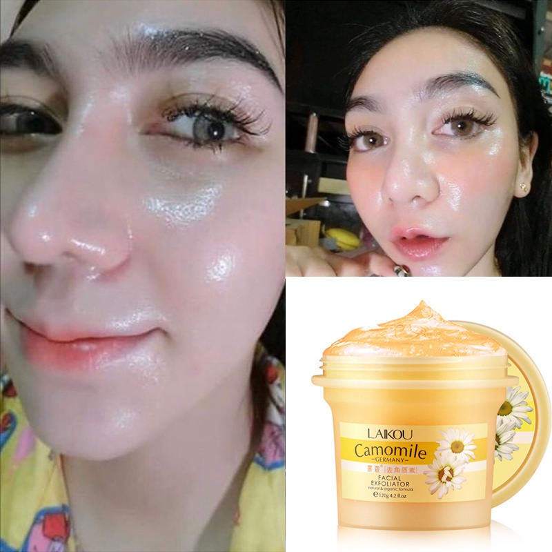 Exfoliating Gel Eksfoliasi Wajah Pemutih Wajah 120g Eksfoliasi Wajah Gel Blackhead Cleaner Body Exfo