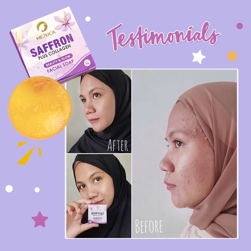 COD MEDAN TERMURAH VIRAL BEST SELLER MEZUCA  Sabun Safron BPOM Pemutih Wajah Alami Ampuh Atasi Jerawat Original Saffron Soap  untuk Muka Berjerawat Flek Hitam Berminyak - Keluarga id