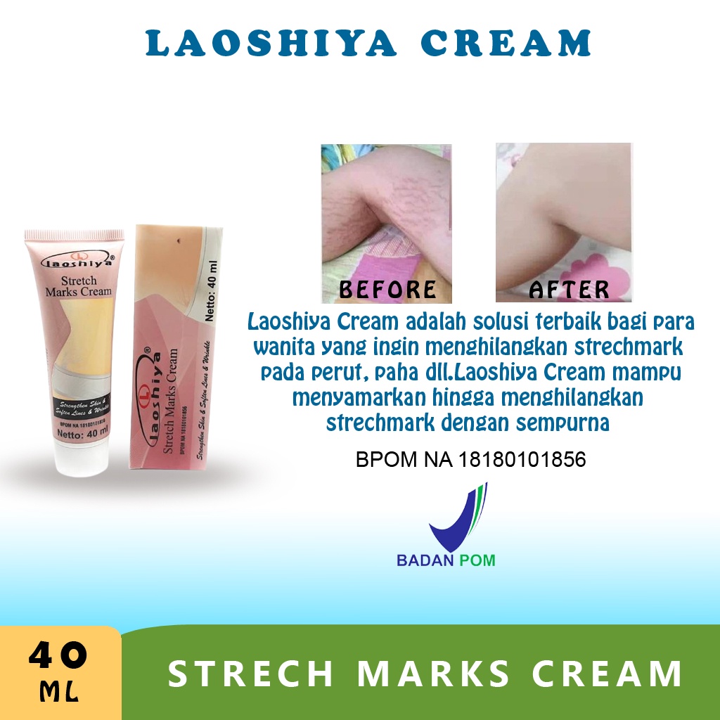 Cream obat Penghilang strechmark stretch mark cream paling ampuh BPOM