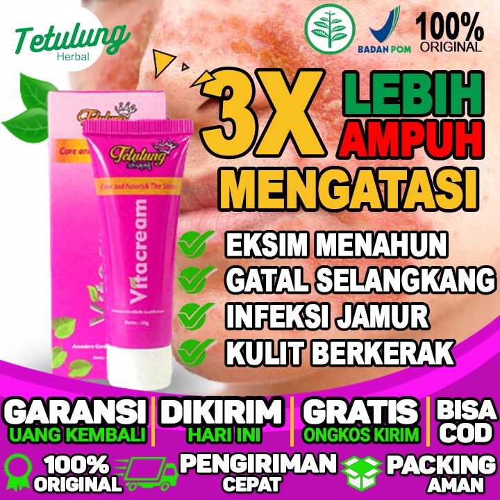 Salep Bisul Untuk Penderita Diabetes  Salep Untuk Bisul Anak  Salep Untuk Bisul Bernanah  eksim mena