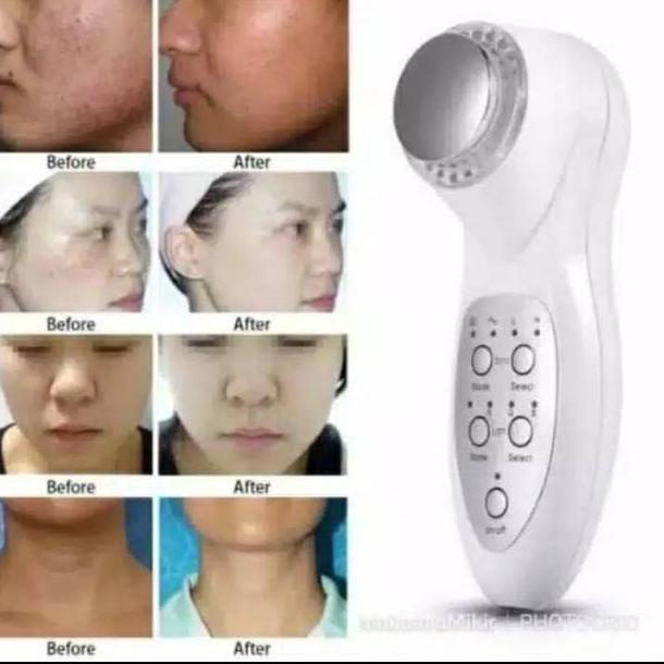 GRATIS ONGKIR ALAT PIJAT WAJAH ULTRASONIK LED 2in1 Alat detox ultrasound setrika wajah pdt light 7 c