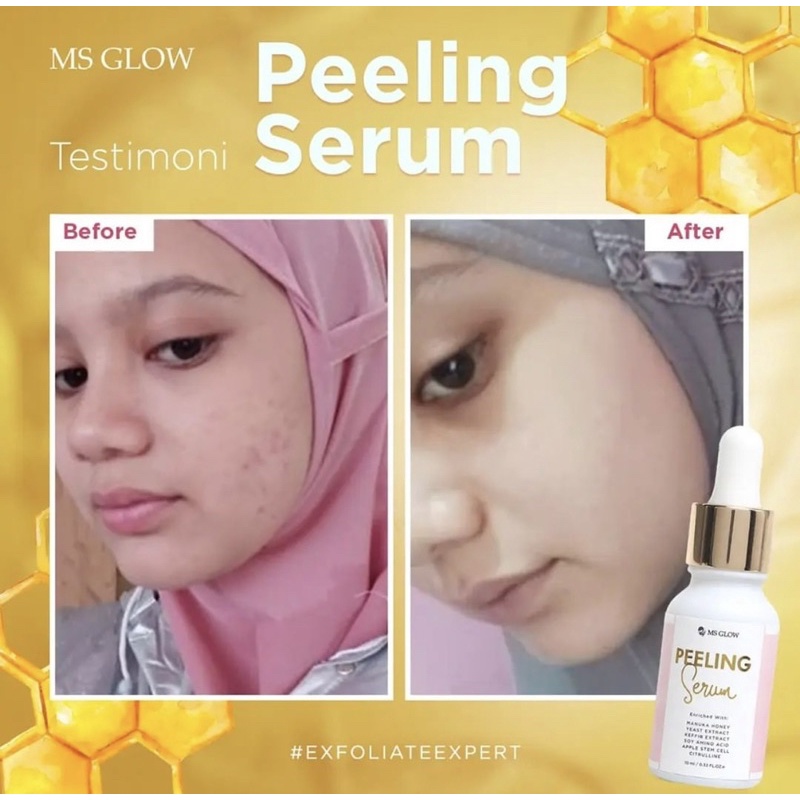 SALE SERUM PEELING MSGLOW