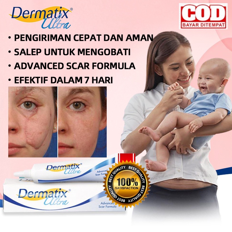 Jual Dermatix Ultra Gr Penghilang Bekas Luka Advanced Scar Stretchmark Anti Scar Keloid Obat