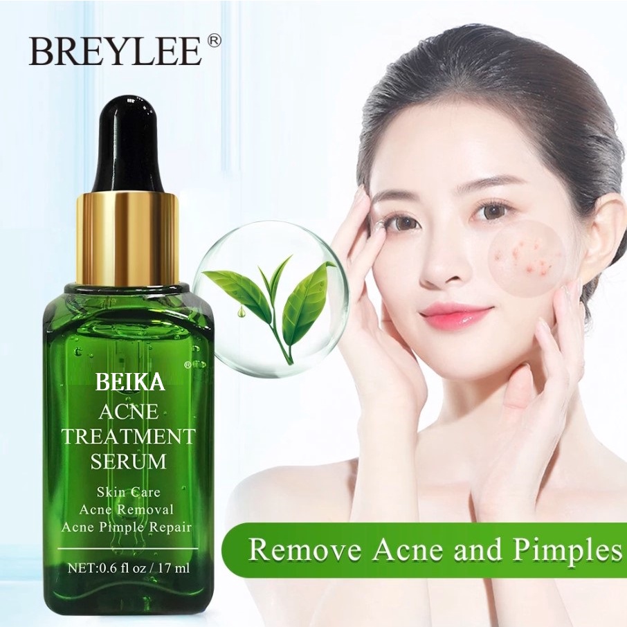 Serum Acne Treatment + Face Cream Anti Acne (2pcs)