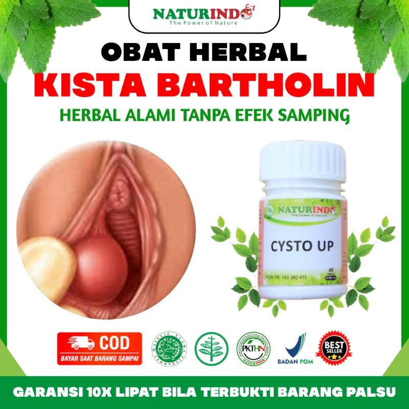 Obat Kista Paling Ampuh Obat Kista Ovarium Tanpa Operasi Kista Bartholin Pelancar Haid keputihan oba