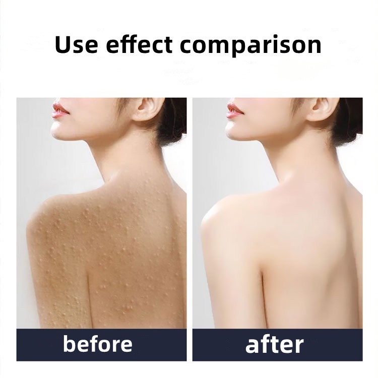 body scrub Lulur pemutih badan Whitening body lotion Lulur tubuh Whitening 250g scrub Scrub pemutih Skin Deep Exfoliating Chicken Skin