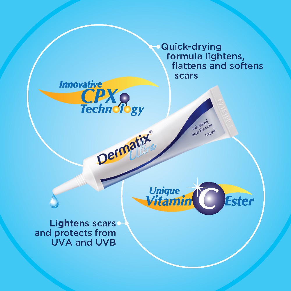 Dermatix Ultra Gel Advanced Scar Formula 15gr Salep Penghilang Bekas Luka/Dermatix Penghilang Bekas Luka/Scar Removal Cream