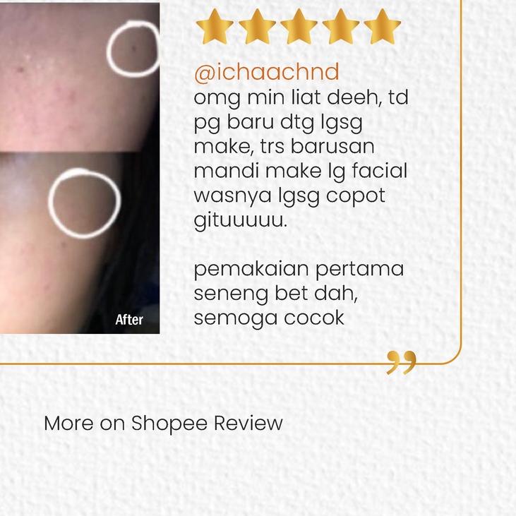 er-1 Anti Aging Day Cream – Krim Pagi Anti Aging - by dr. Erna Purnamasari
