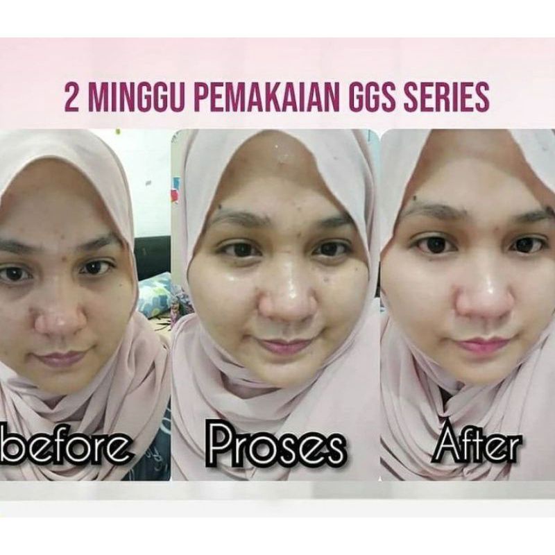GGS SERIES GLOW GLASS SKIN SR12 HERBAL SKINCARE BPOM - KRIM GLOWING DALAM 1 MINGGU MENGHILANGKAN FLEK JERAWAT KRIM GLOWING KOREA PEMUTIH CEPAT ALAMI AMAN BPOM SKINCARE