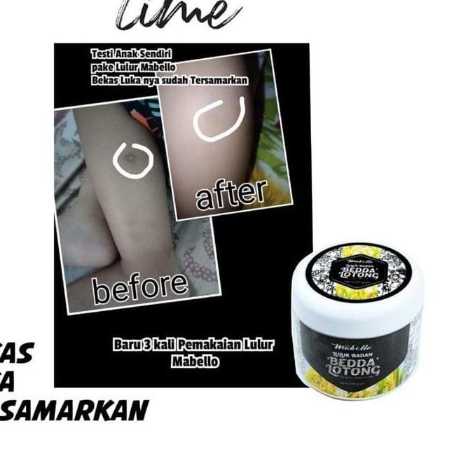 EXCLUSIVE❤️ RG ❤️ MABELLO Lulur Bedda Lotong Rempah Original BPOM 300 Gram | Mabelloindonesia|SQ7