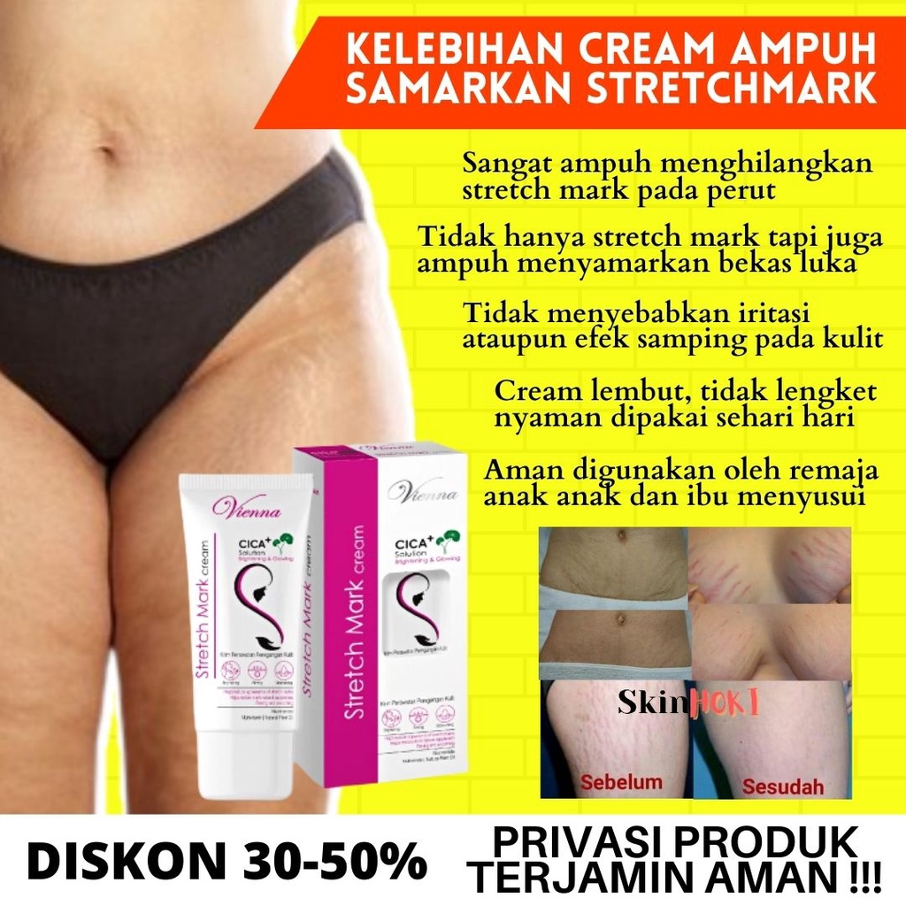 PENGHILANG STRETCH MARK PERMANEN AMPUH PENGHALUS KULIT VIENNA STRETCHMARK CREAM 80ML PERAWATAN KULIT ORIGINAL BPOM