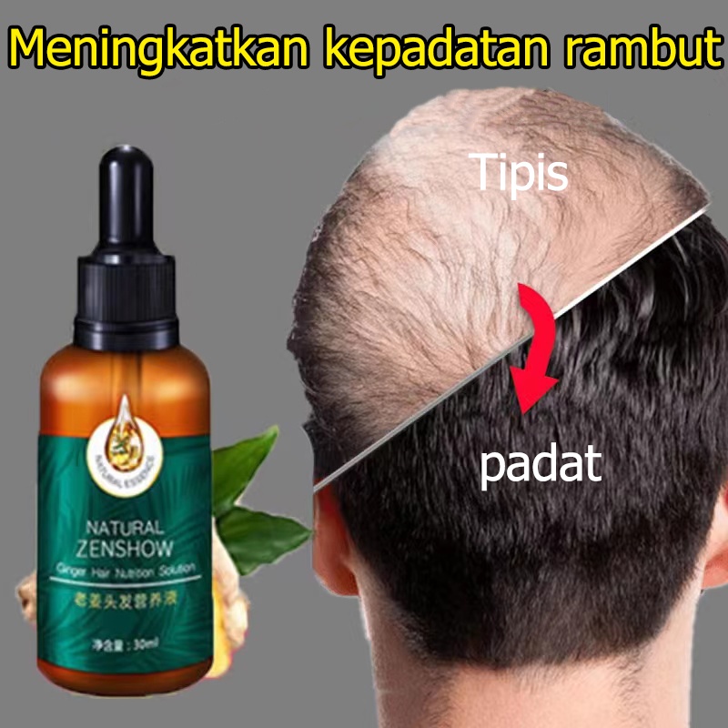 [ PENUMBUH RAMBUT BOTAK ] Anti Rontok / Botak Asli Obat Penghitam Penyubur Original