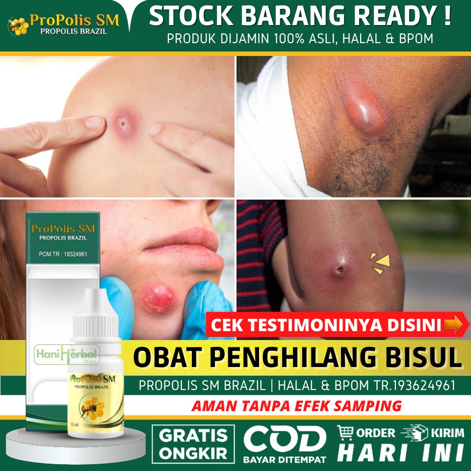 Obat Bisul Alami 100% AMAN - Obat Bisul di Ketiak / Kepala / Telinga / Mata / Pantat PROPOLIS BRAZIL