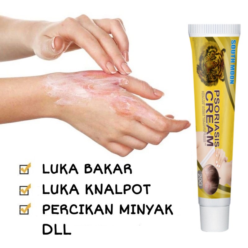 Salep gatal Salep kulit Salep Eksim Krim psoriasis paling ampuh Kulit Kepala Psoriasis Tangan Tinea Kaki Bau 20g Dermatitis Jamur Anti