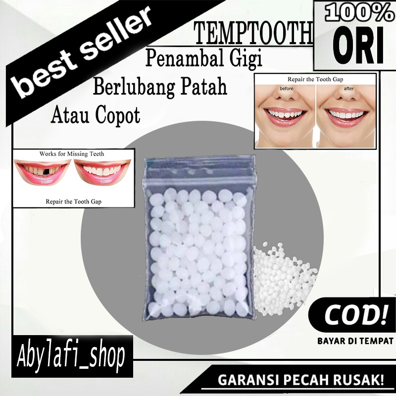 GIGI PALSU SEMENTARA / PENAMBAL GIGI PATAH RENGGANG TEMPORARY TOOTH TEMPTOOTH GINGSUL PATAH KELINCI