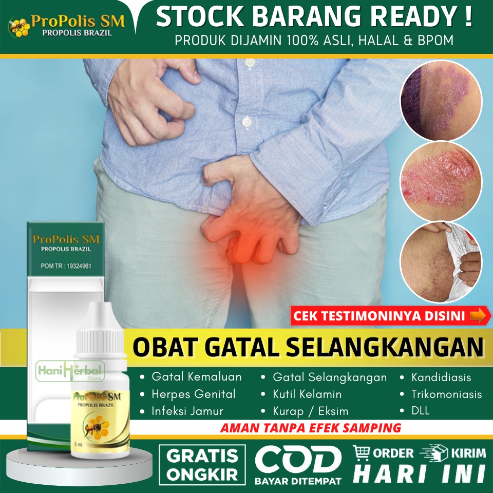 Obat Selangkangan Hitam dan Gatal Untuk Pria / Wanita, Penghilang Jamur di Selangkangan, Obat Selang