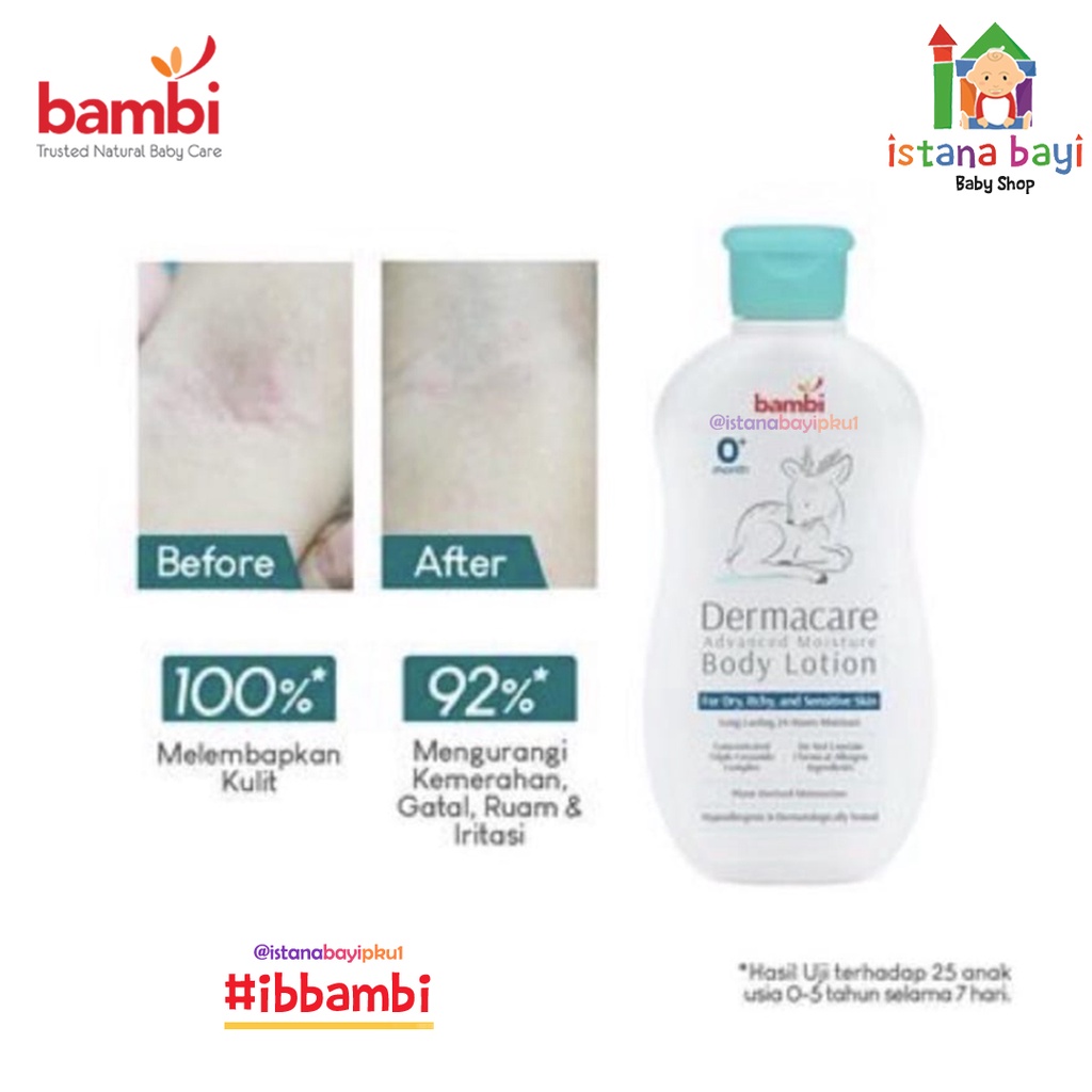 Bambi Baby Dermacare Advance Moisture Body Lotion 200ml | Lotion Pelembab Bayi Anak Khusu Kulit Atopic