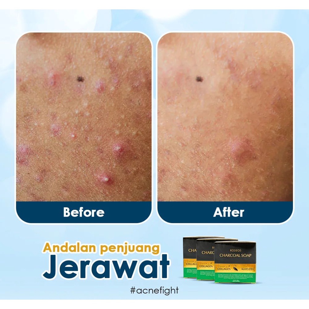 Rodeos Charcoal Soap 80gr - Sabun Pembersih Wajah Pria Original