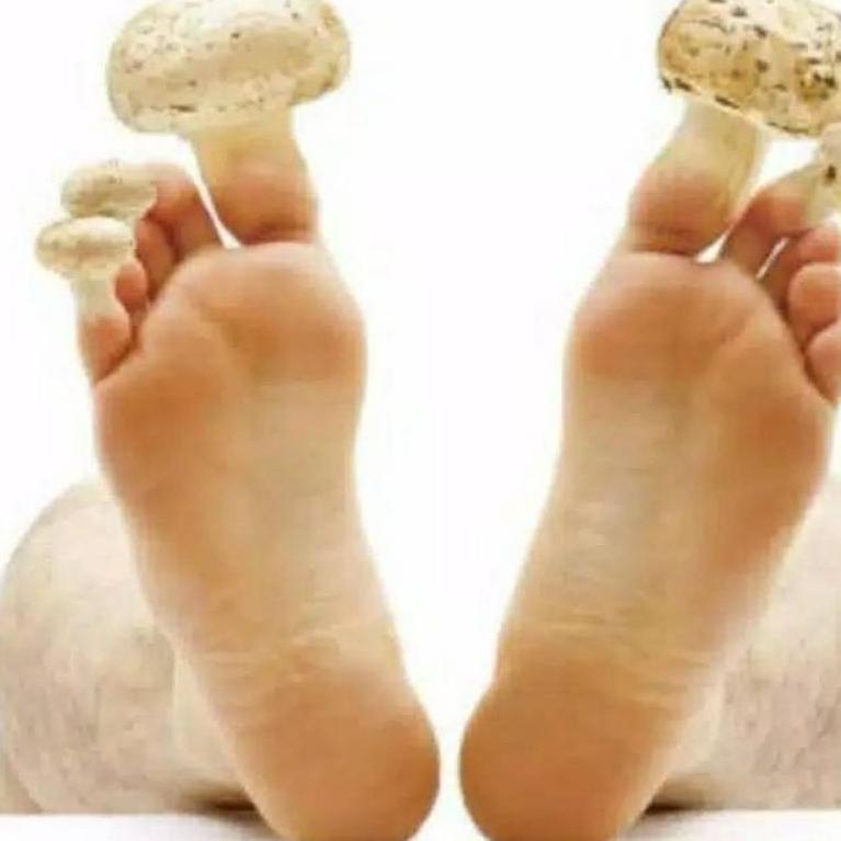 [TMM.18Oc22o] Nomidol Original - Cream Nomidol Obat Jamur Kuku Aman