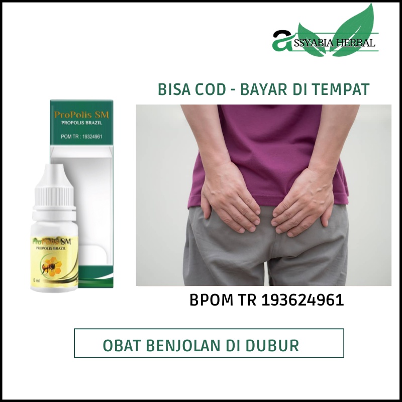 Obat Benjolan di Anus, Abses Anus, Bisul di Pantat, Benjolan di Dubur, Wasir Luar, Ambeien Berdarah,